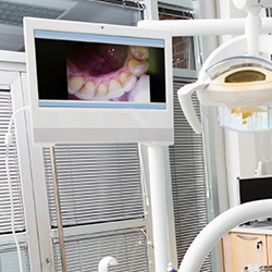 Intraoral photos on chairside monitor