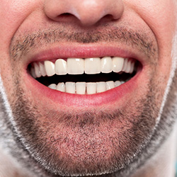 Closeup of man's healthy smile