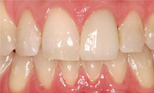 Beautiful smile with healthy gums