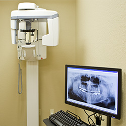 CT Cone beam scanner