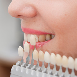 Closeup of teeth compared with tooth color chart