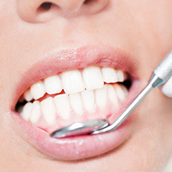 Closeup of healthy smile