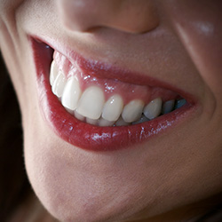 Closeup of healthy flawless smile