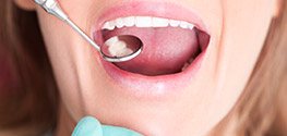 Closeup of smile during dental exam